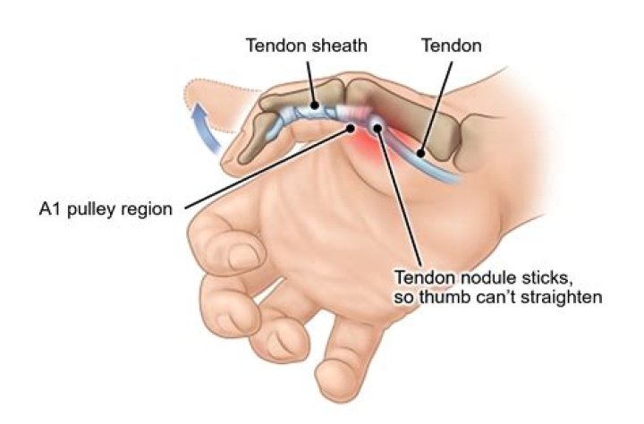 Where does your thumb go when punching?