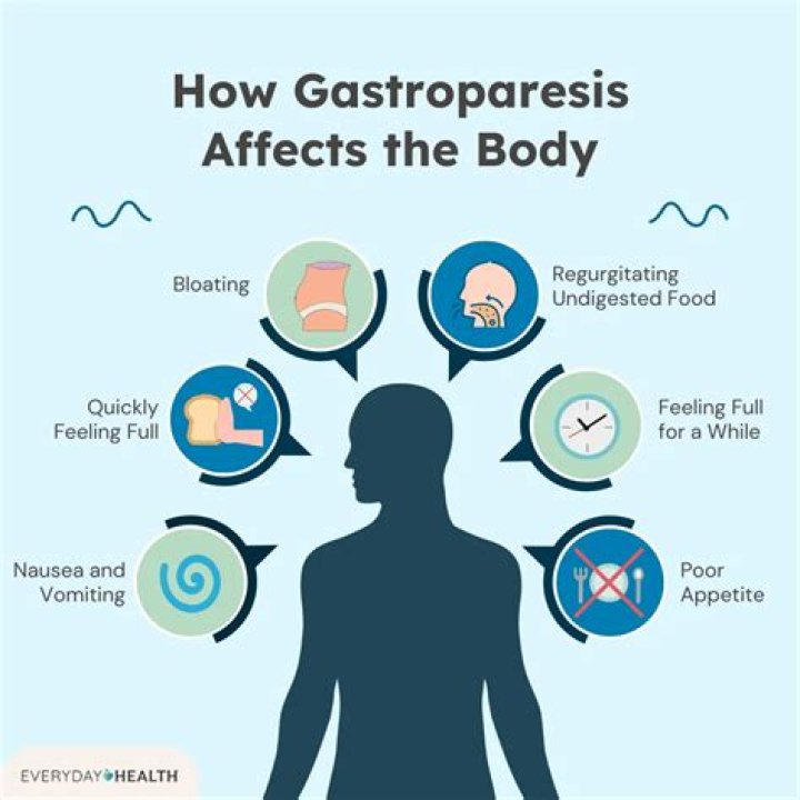 Where is gastroparesis pain located?