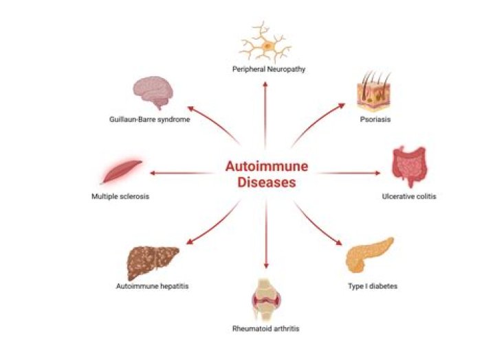 Which autoimmune disease causes eczema?