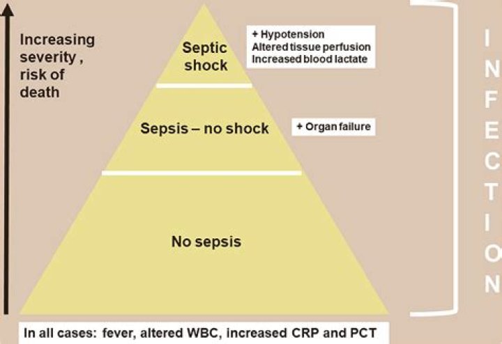 Which is worse sepsis or septic shock?