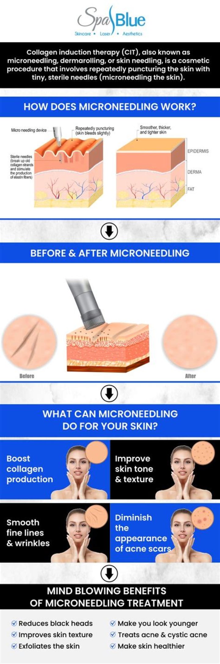Who is a candidate for microneedling?