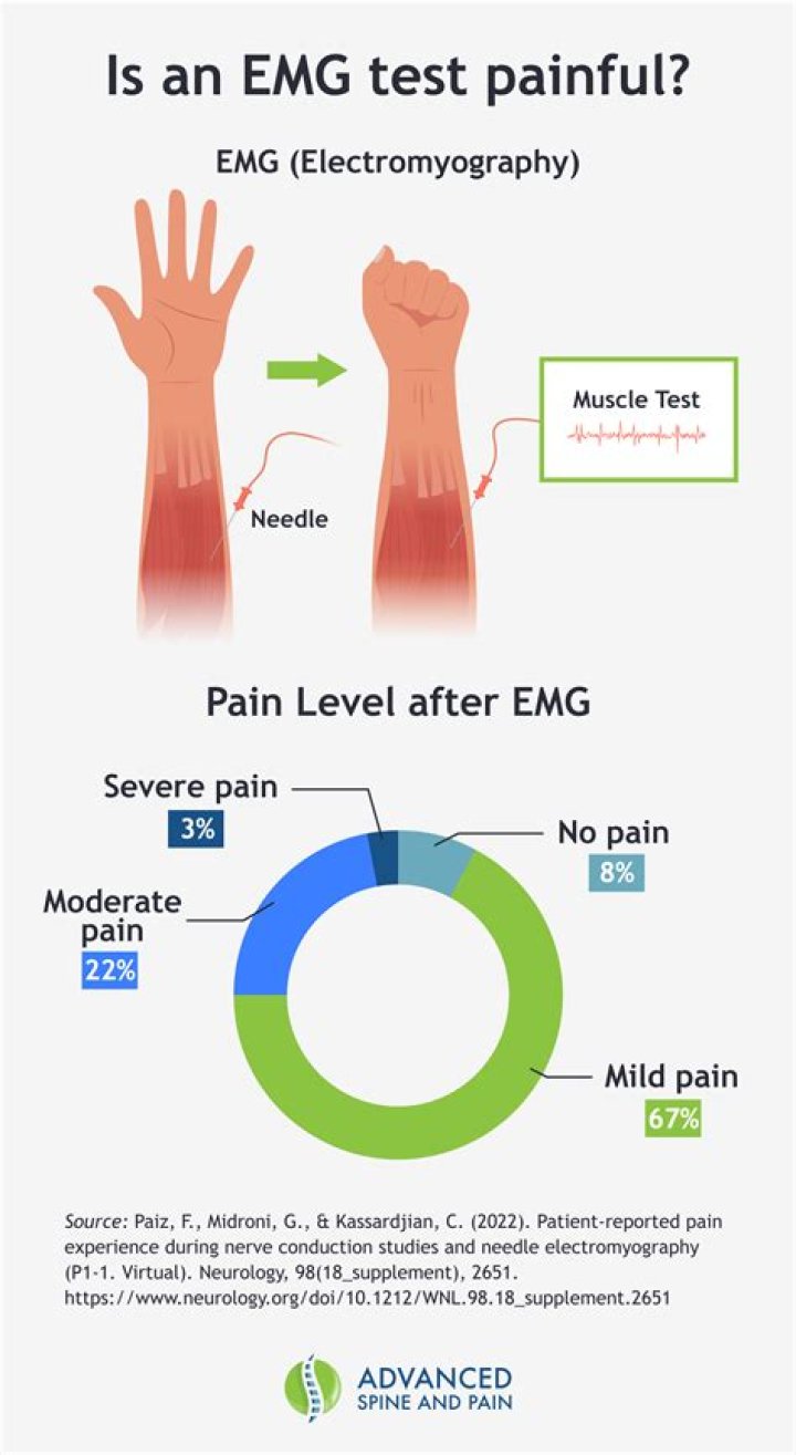 Who performs an EMG test?