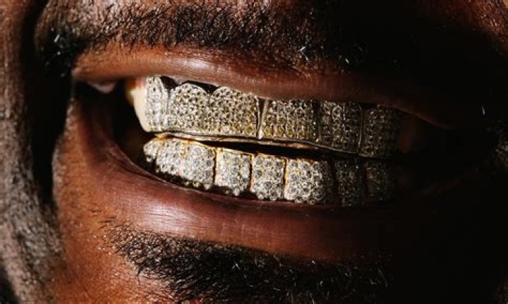 Who started gold teeth?