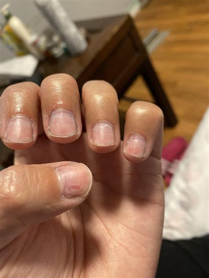 Why are dip nails so thick?
