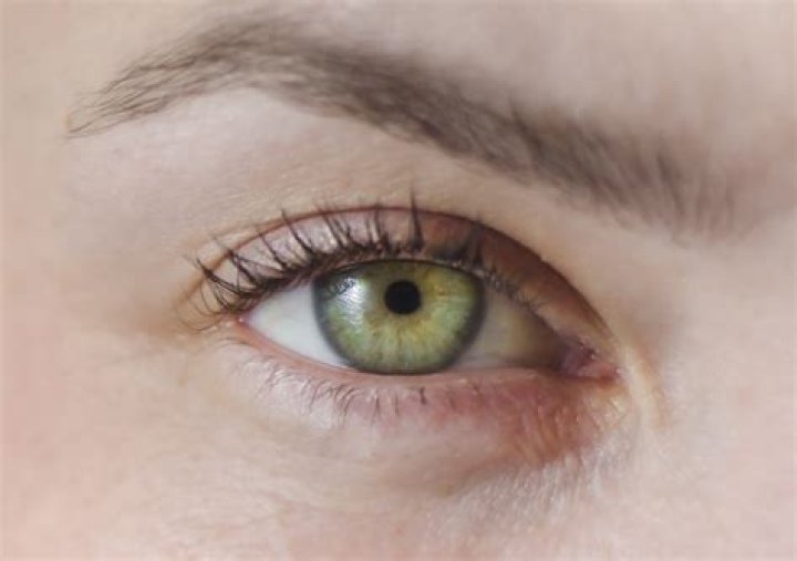 Why are green eyes associated with jealousy?