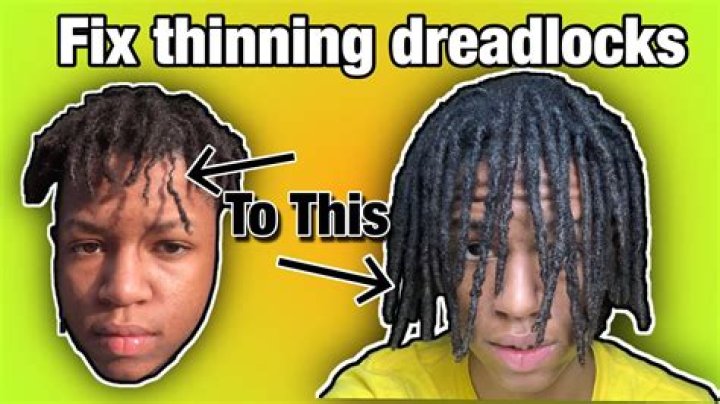 Why are my dreads getting skinny?