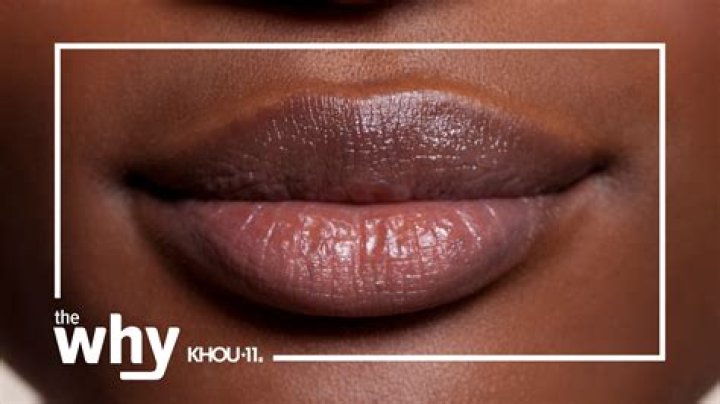 Why are my lips Brown?