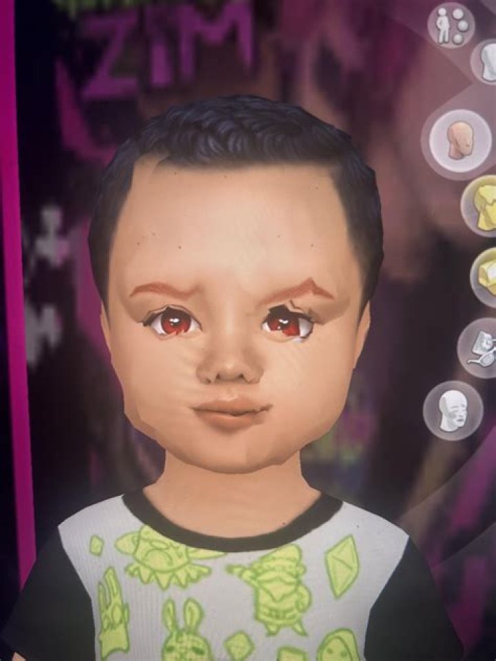Why are my toddlers lips black?