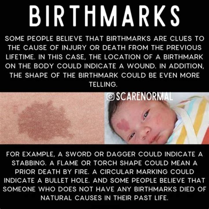 Why do birthmarks happen?