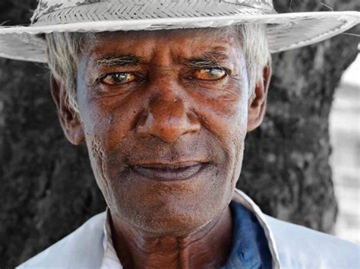 Why do blind people's eyes turn white?