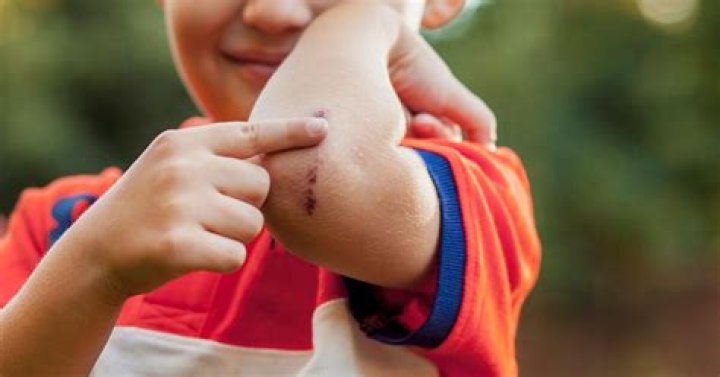 Why do I pick my scabs?