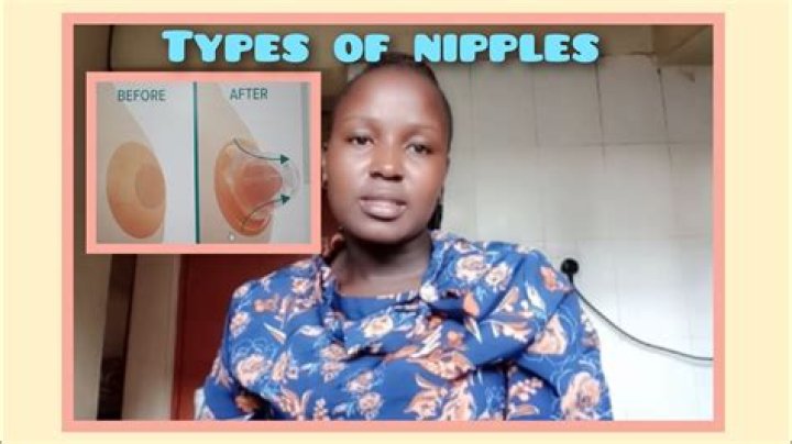 Why do males have nipples?