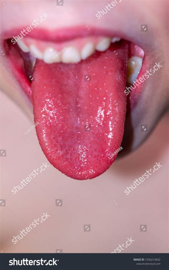Why do strawberries burn my tongue?