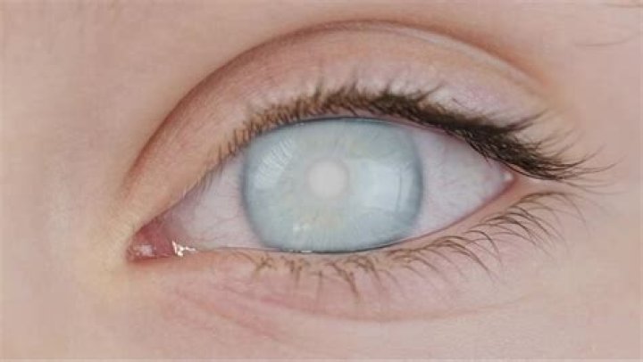 Why do Thenas eyes turn white Eternals?