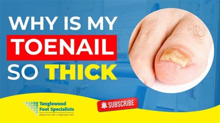 Why do toe nails get thick with age?
