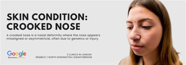 Why does Cameron mean crooked nose?