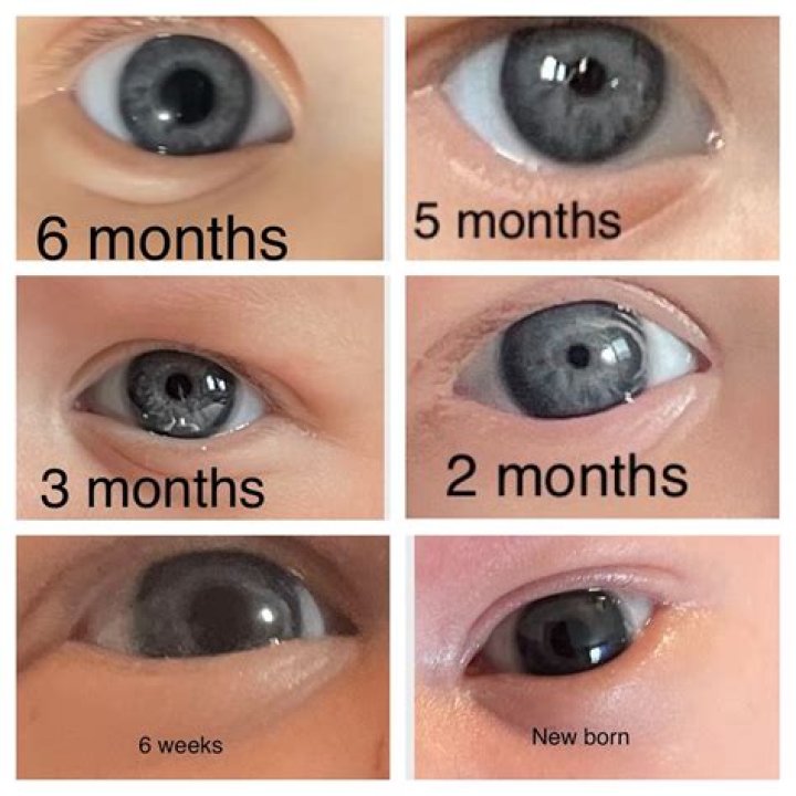 Why does my baby have black eyes?