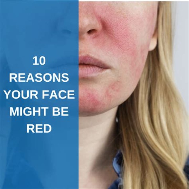 Why does my face get dark so easily?