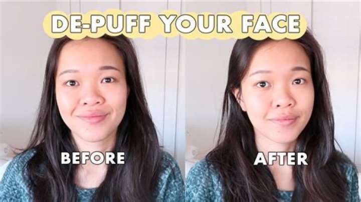 Why does my face puff up when I cry?