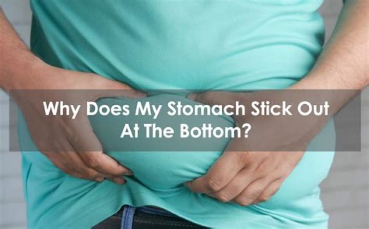 Why does my stomach stick out below my belly button?