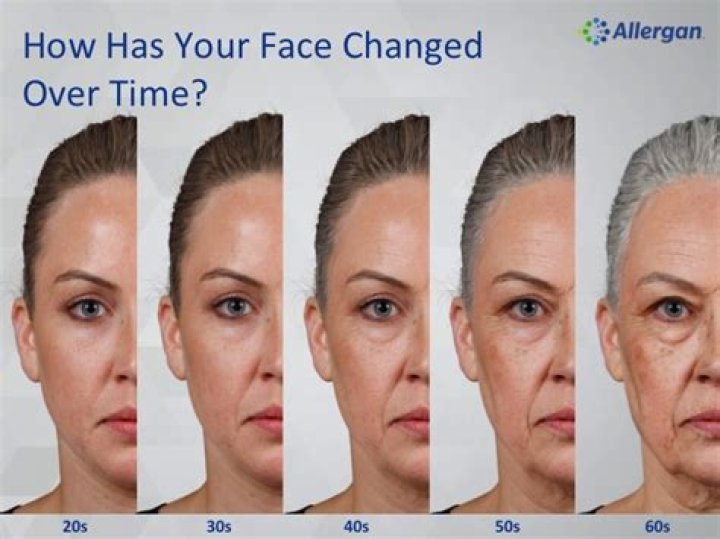Why does your face change as you age?