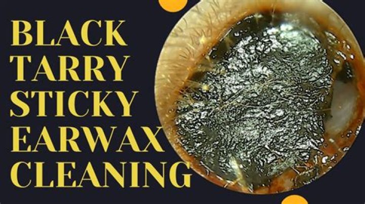 Why is my earwax sticky?