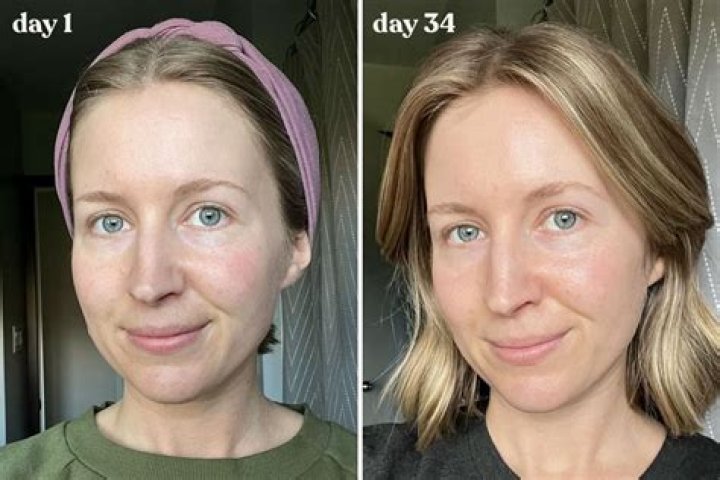 Why is my face shiny after skincare?