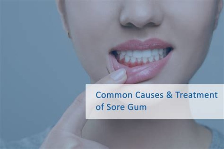 Why is my gum still sore a week after extraction?
