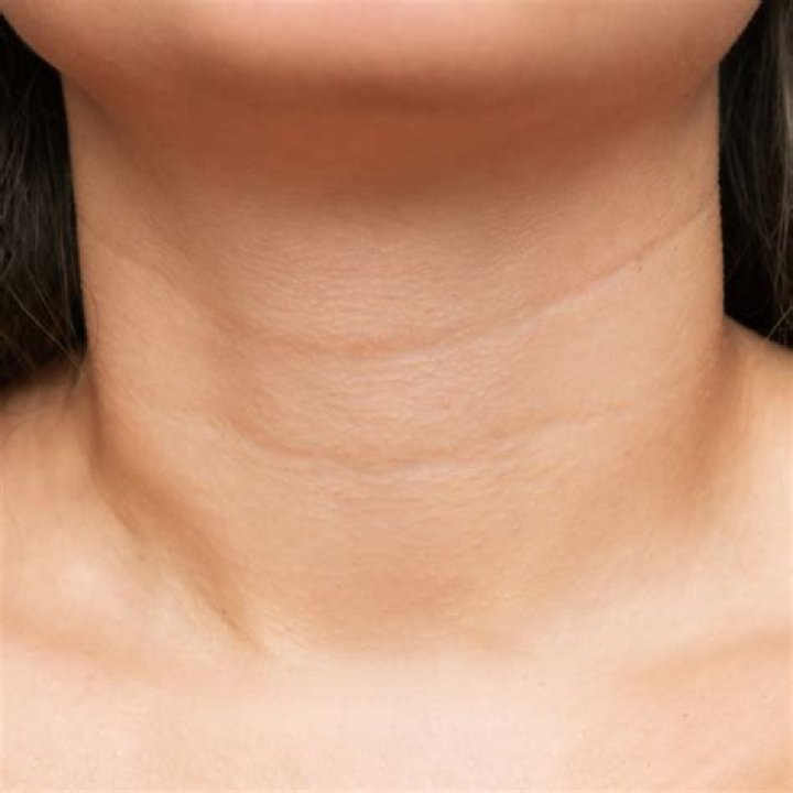 Why is my neck so hairy female?