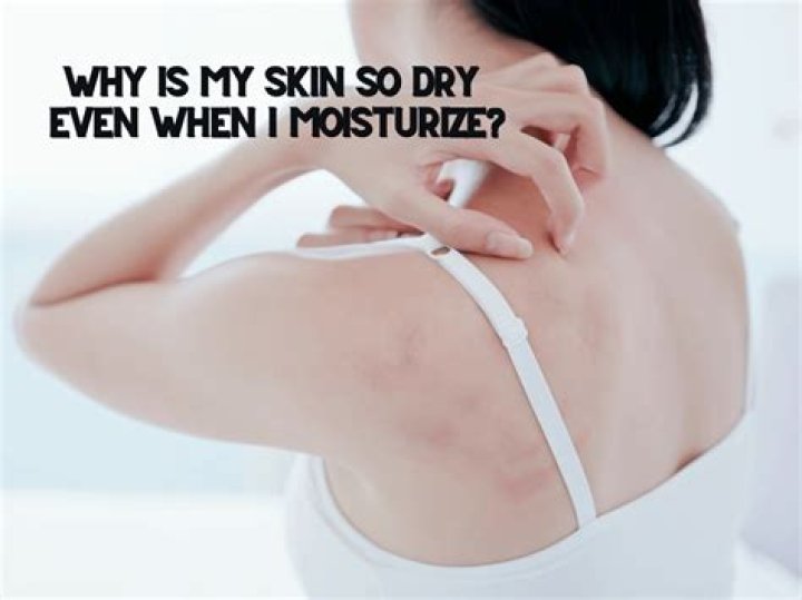 Why is my skin so dry even when I moisturize?