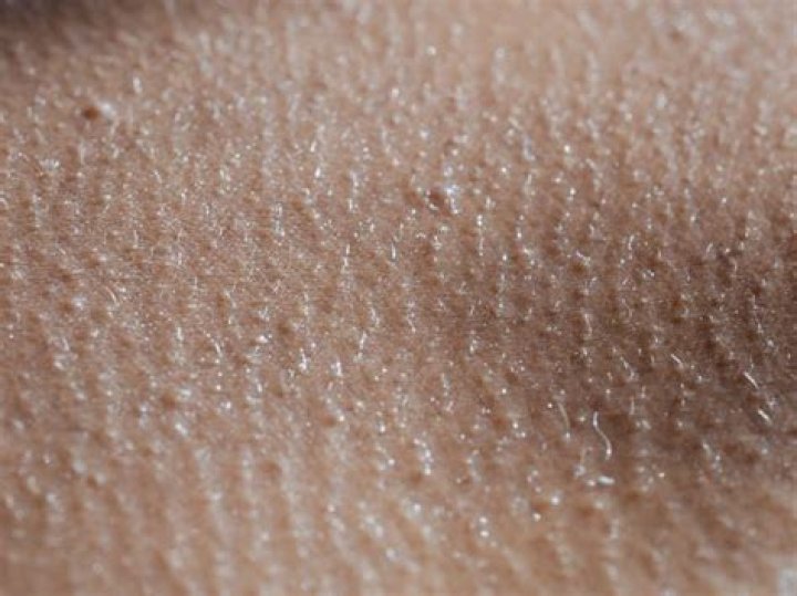 Why is my skin suddenly so textured?