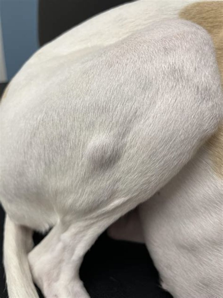 Why is there a lump on my scar?