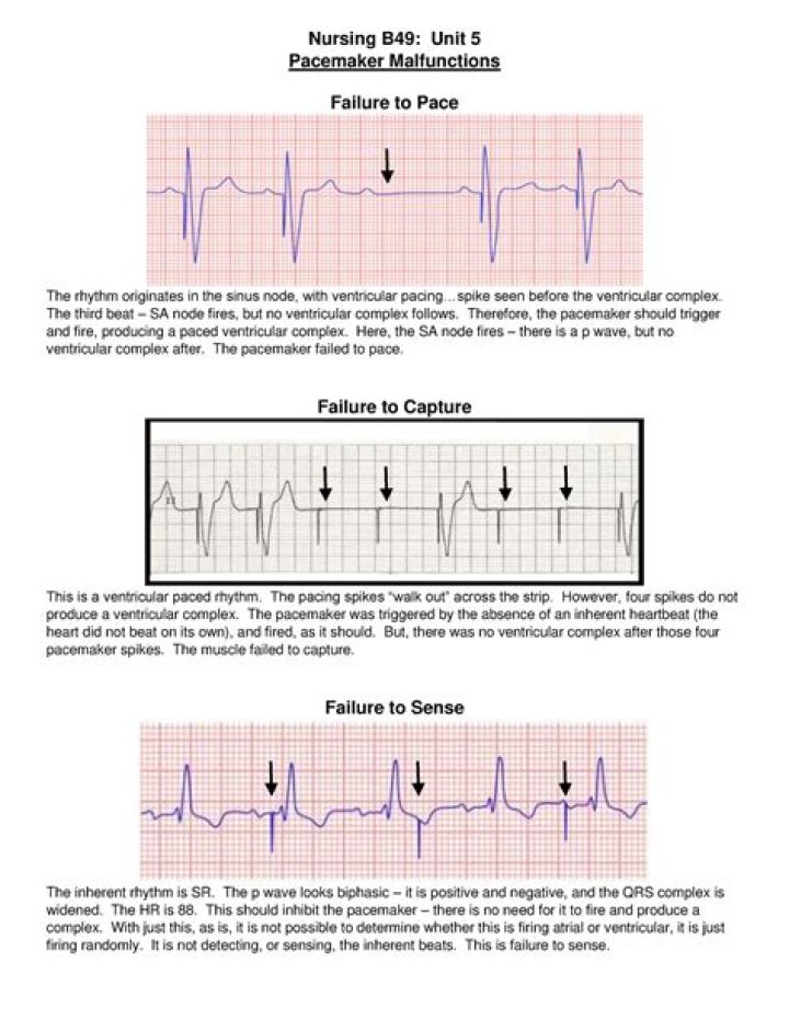 Why was the Newton a failure?