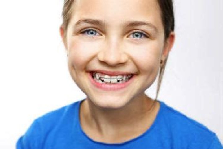 Why would a 7 year old have braces?