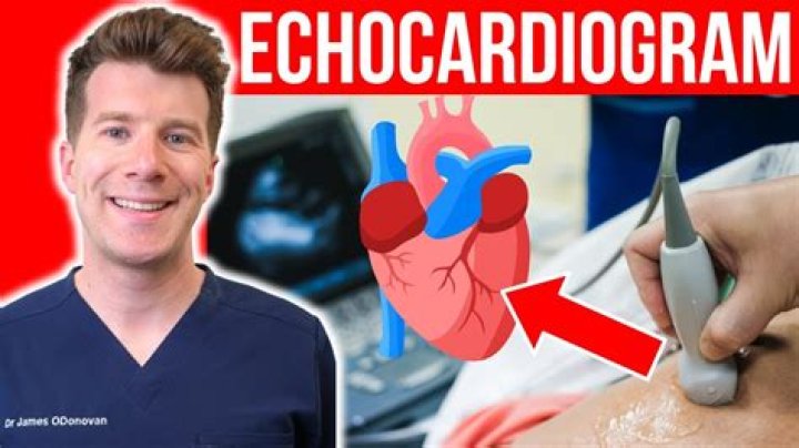 Why would a doctor order a heart CT scan?