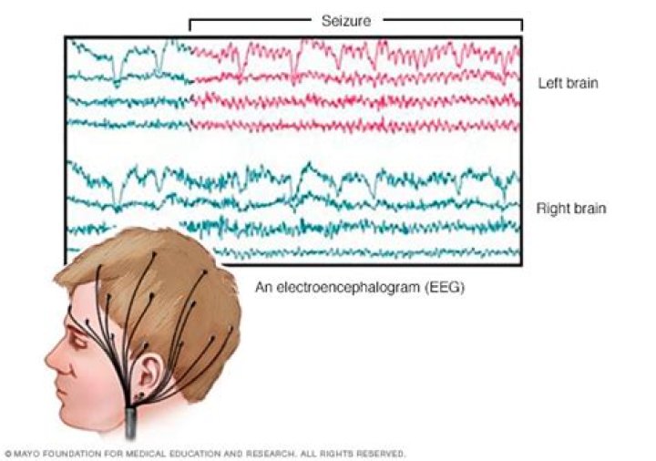 Will an EEG show past seizures?