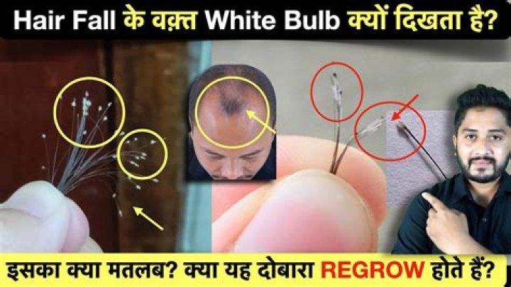 Will hair with white bulb grow back?
