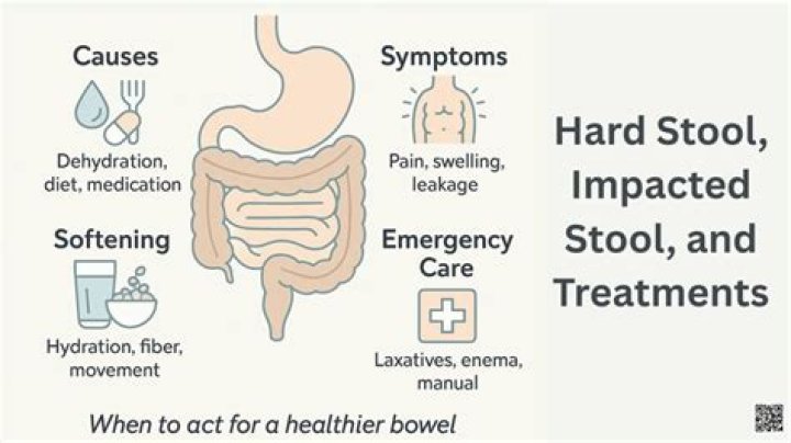 Will Metamucil help impacted stool?
