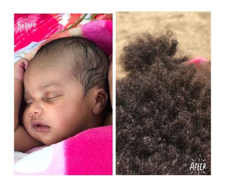 Will my baby have a lot of hair?